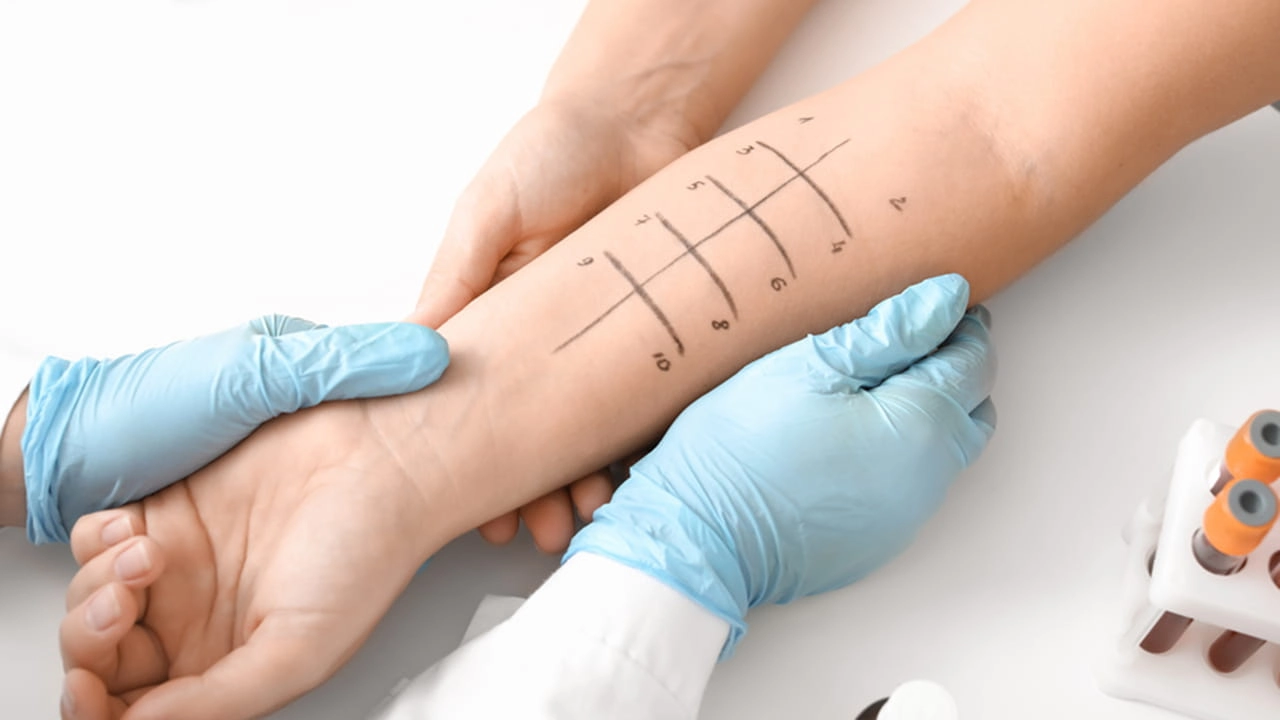 dermatologist testing - RYSUN
