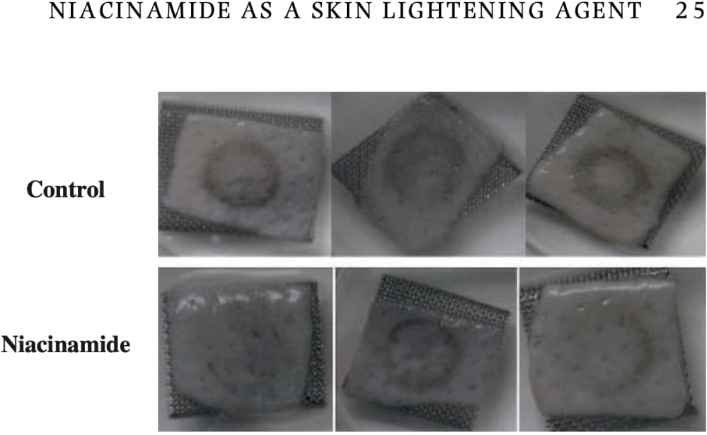 Niacinamide as a skin whitening agent