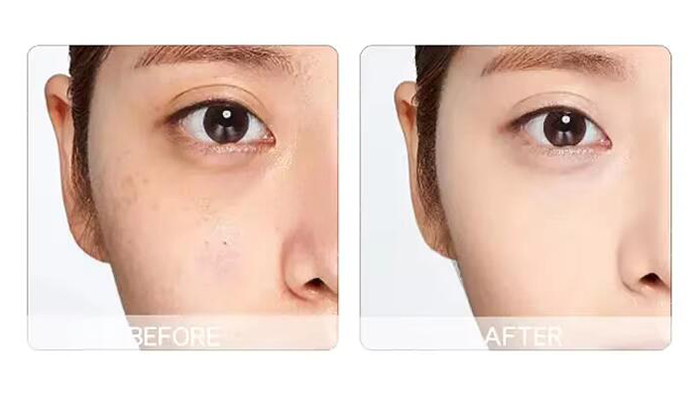 vitamin c serum solution1